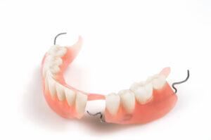 Interim Partial Denture 1 Product Catalog