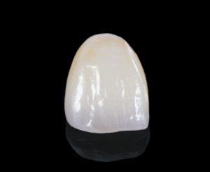 emax anterior